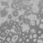 【4/22(水)】久留米市で新たに10人の感染を確認　新型コロナウイルス